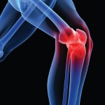 Knee pain image